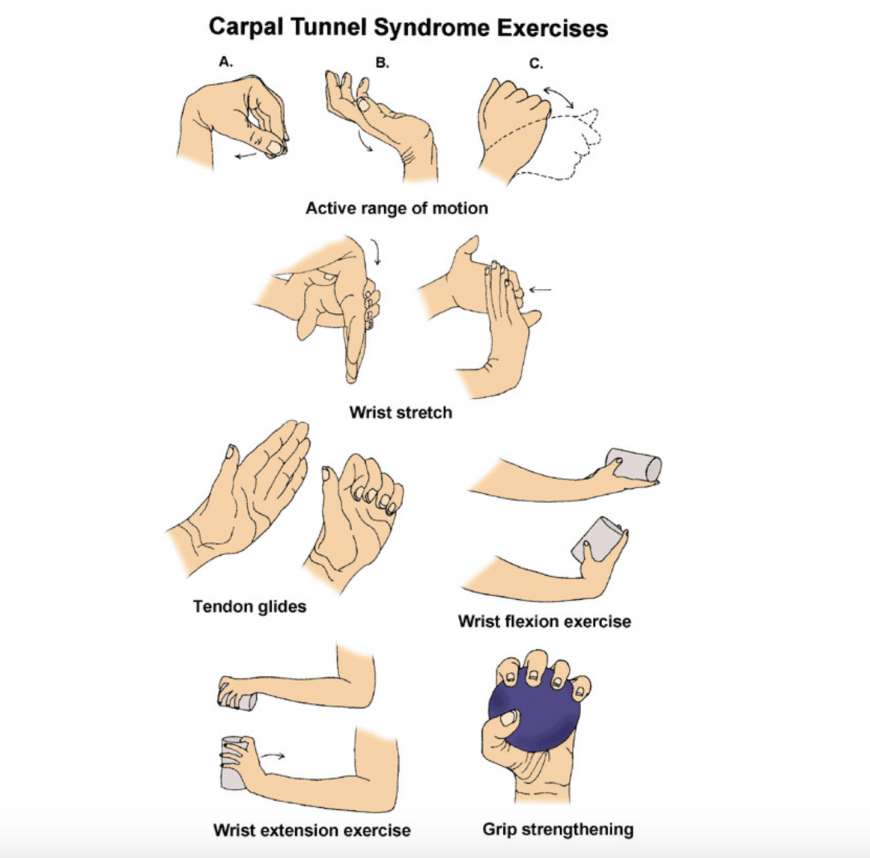 Carpal tunnel syndrome hand exercises for pregnant women in Dubai